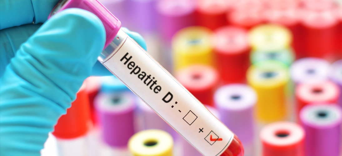 Un espoir dans le traitement de l’hépatite D